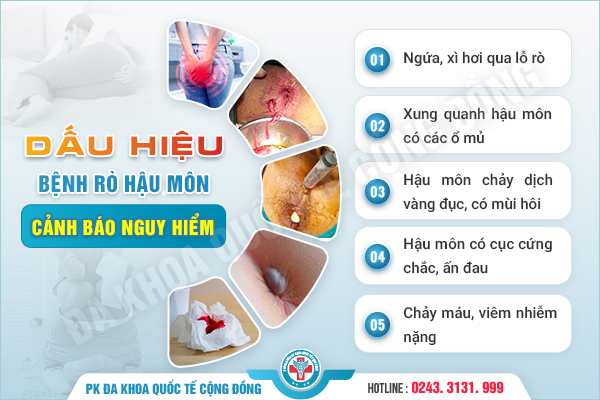 Rò hậu môn
